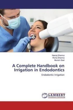 A Complete Handbook on Irrigation in Endodontics