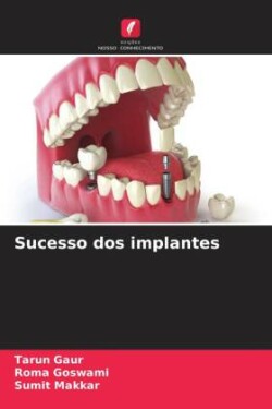 Sucesso dos implantes