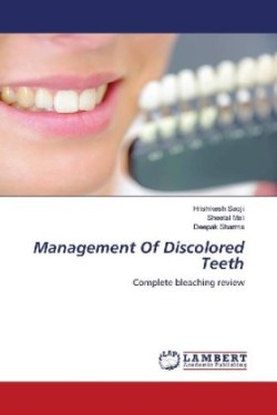 Management Of Discolored Teeth