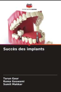 Succès des implants