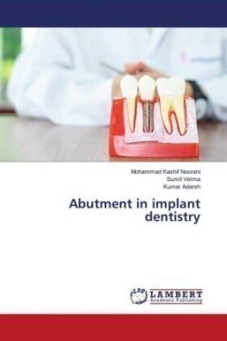 Abutment in implant dentistry