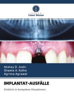 IMPLANTAT-AUSFÄLLE