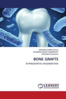 BONE GRAFTS