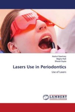 Lasers Use in Periodontics