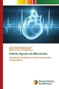 Infarto Agudo do Miocárdio