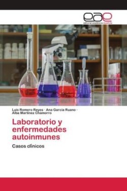 Laboratorio y enfermedades autoinmunes