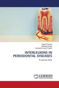 Interleukins in Periodontal Diseases
