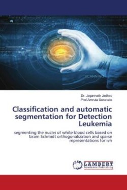 Classification and automatic segmentation for Detection Leukemia