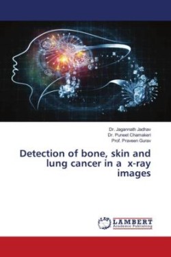 Detection of bone, skin and lung cancer in a x-ray images
