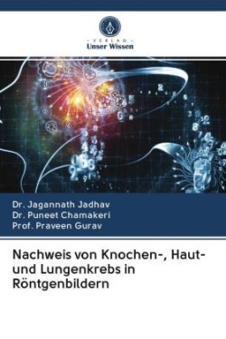 Nachweis von Knochen-, Haut- und Lungenkrebs in Röntgenbildern