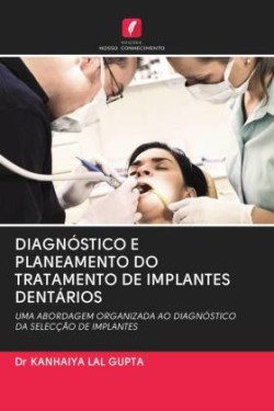 Diagnóstico E Planeamento Do Tratamento de Implantes Dentários