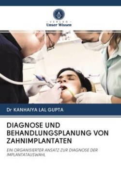 Diagnose Und Behandlungsplanung Von Zahnimplantaten