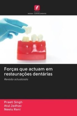 Forças que actuam em restaurações dentárias