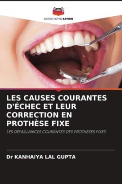 LES CAUSES COURANTES D'ÉCHEC ET LEUR CORRECTION EN PROTHÈSE FIXE