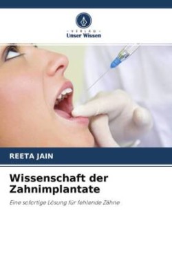 Wissenschaft der Zahnimplantate