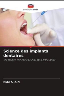 Science des implants dentaires