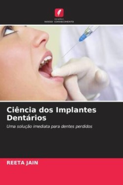 Ciência dos Implantes Dentários