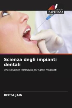 Scienza degli impianti dentali