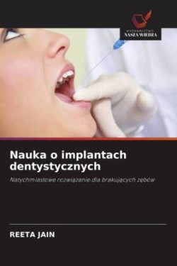 Nauka o implantach dentystycznych