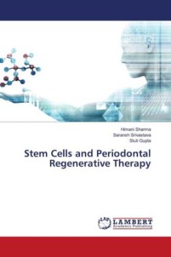 Stem Cells and Periodontal Regenerative Therapy