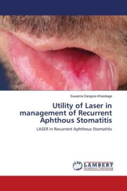 Utility of Laser in management of Recurrent Aphthous Stomatitis