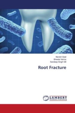 Root Fracture