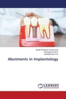 Abutments in Implantology