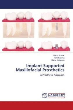 Implant Supported Maxillofacial Prosthetics