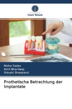 Prothetische Betrachtung der Implantate