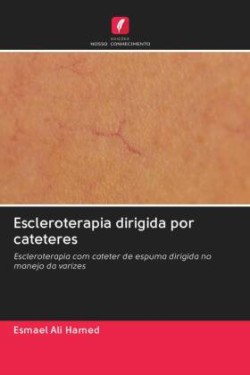 Escleroterapia dirigida por cateteres