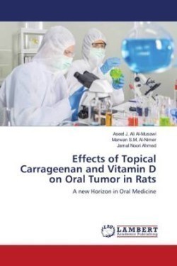 Effects of Topical Carrageenan and Vitamin D on Oral Tumor in Rats