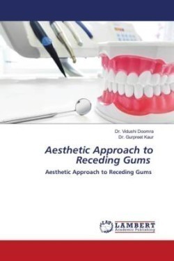 Aesthetic Approach to Receding Gums