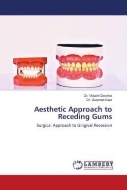 Aesthetic Approach to Receding Gums