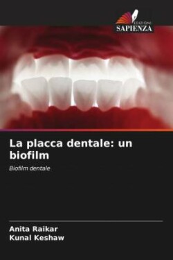 placca dentale