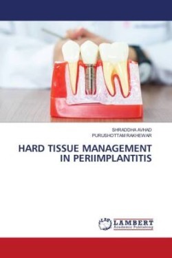 Hard Tissue Management in Periimplantitis