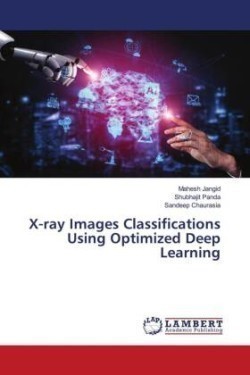 X-ray Images Classifications Using Optimized Deep Learning