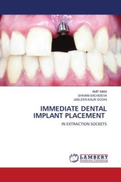 Immediate Dental Implant Placement