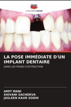 Pose Immédiate d'Un Implant Dentaire