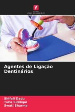 Agentes de Ligação Dentinários