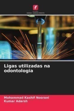 Ligas utilizadas na odontologia