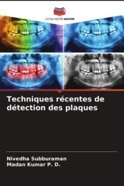 Techniques récentes de détection des plaques