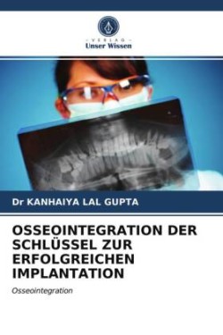 OSSEOINTEGRATION DER SCHLÜSSEL ZUR ERFOLGREICHEN IMPLANTATION