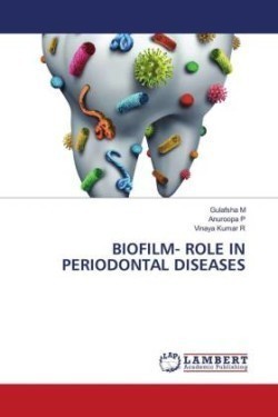 Biofilm- Role in Periodontal Diseases