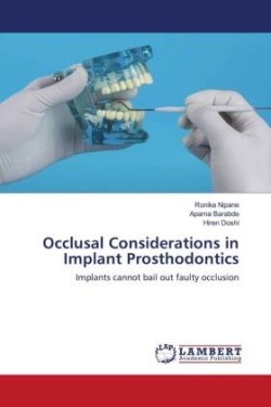 Occlusal Considerations in Implant Prosthodontics