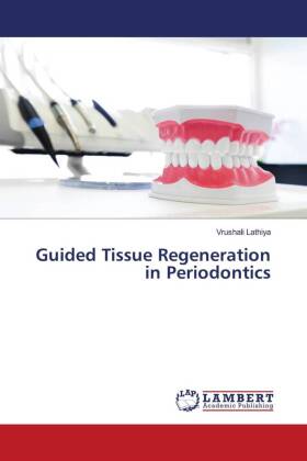 Guided Tissue Regeneration in Periodontics