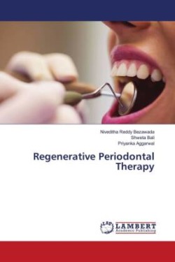 Regenerative Periodontal Therapy