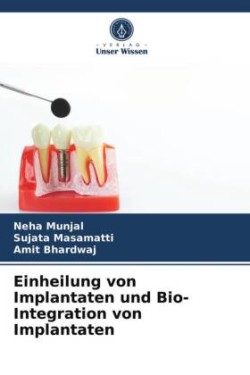 Einheilung von Implantaten und Bio- Integration von Implantaten