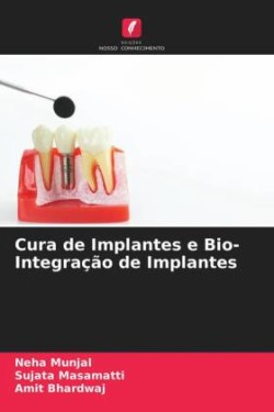Cura de Implantes e Bio- Integração de Implantes