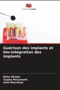 Guérison des implants et bio-intégration des implants