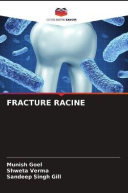 Fracture Racine